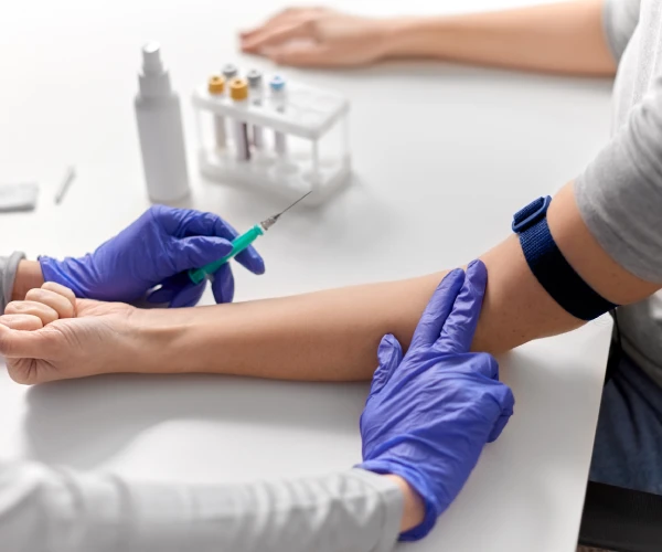 Prueba de sangre a domicilio en cdmx