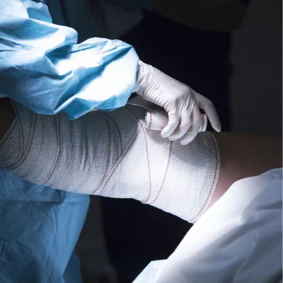 ¿Qué especialista trata las fracturas en CDMX?